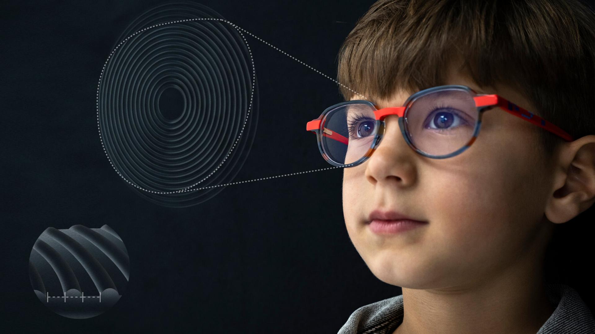 Ilustracija izbliza dizajna ZEISS MyoCare leća za kontrolu kratkovidnosti u djece.